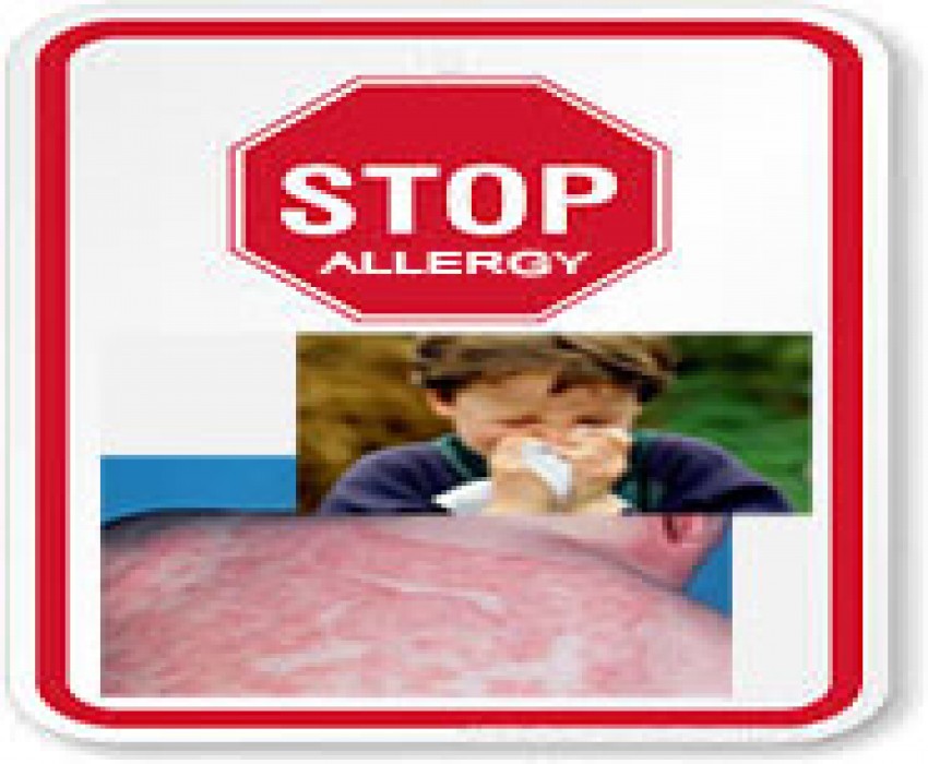 Allergy Prohibited