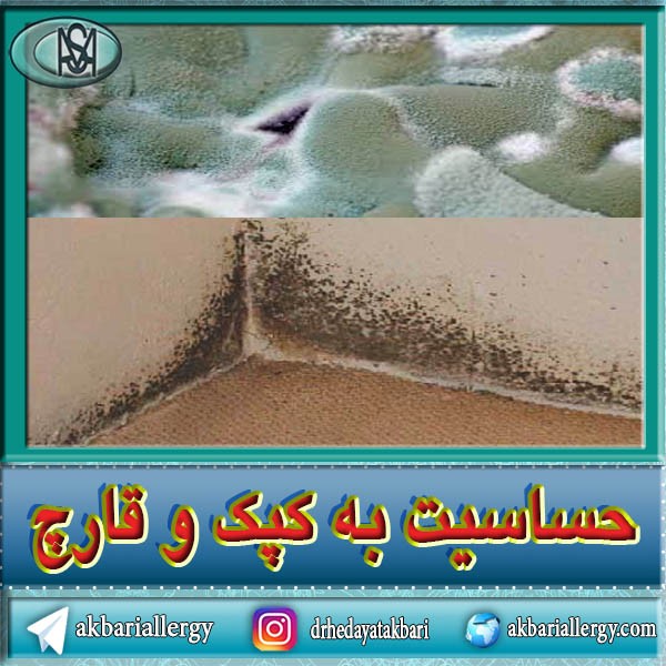 حساسیت به کپک وقارچ